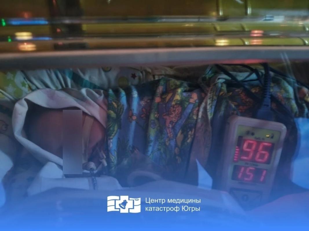 Югорчанка родила недоношенную дочь дома: скорую вызвал старший ребенок 